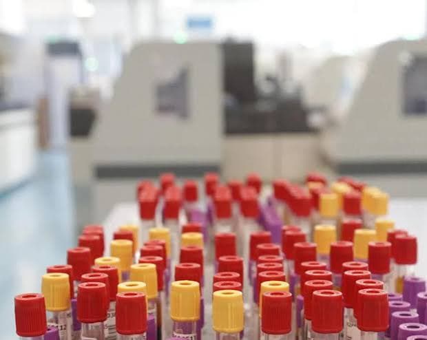 A Francoforte otto casi di malaria: tre decessi nell'area dell'aeroporto