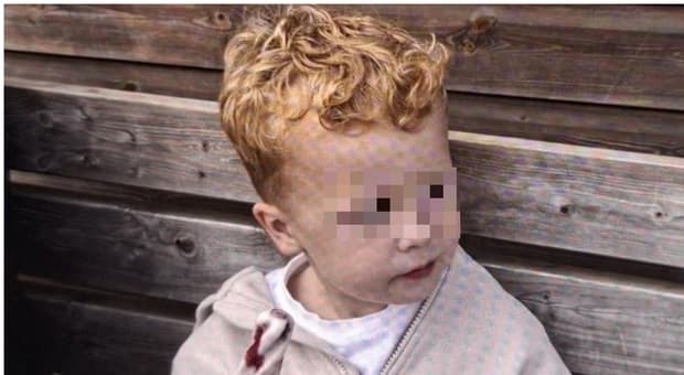  Noah Woods, trovato morto in uno stagno il bimbo di 3 anni scomparso in un parco giochi: due giorni di ricerche in Gb, poi la tragica svolta 