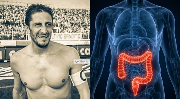  Protti morto per un tumore al colon: sintomi, prevenzione e cure della malattia che lo aveva colpito 