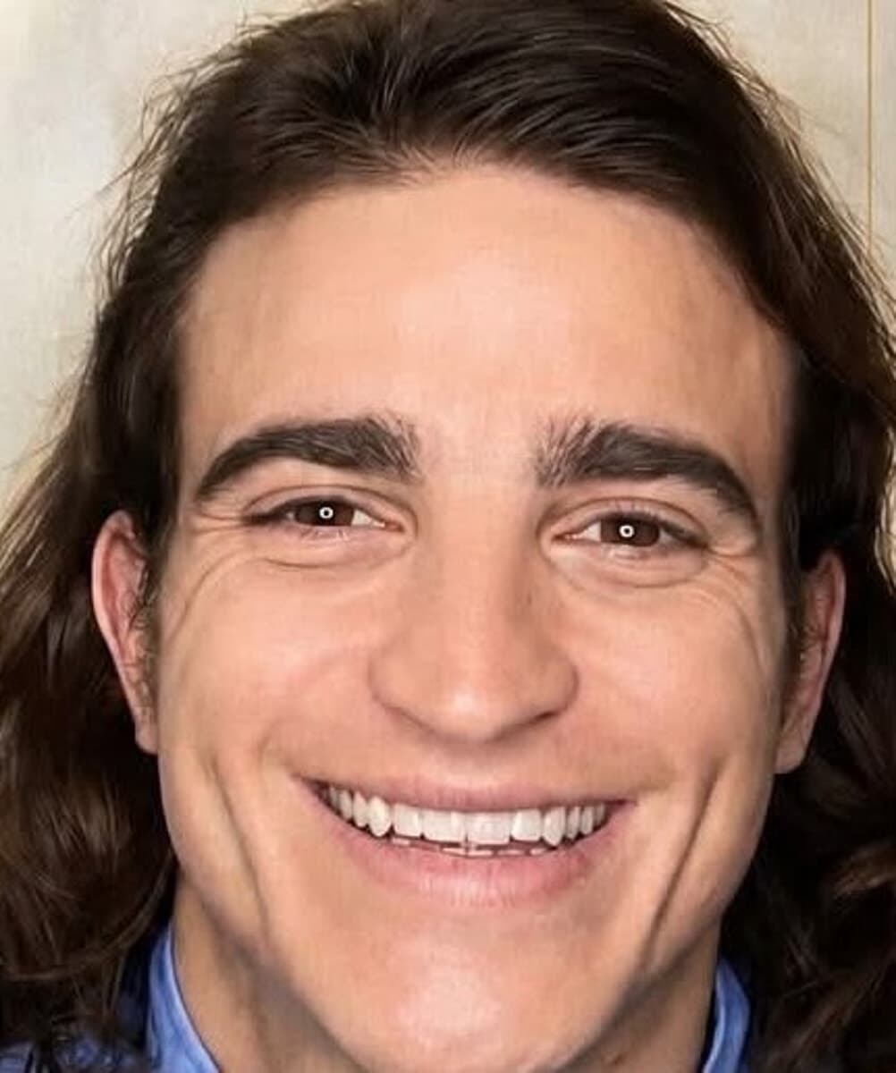 Tragico incidente a Roma, muore il dentista Federico Derla: aveva 33 anni