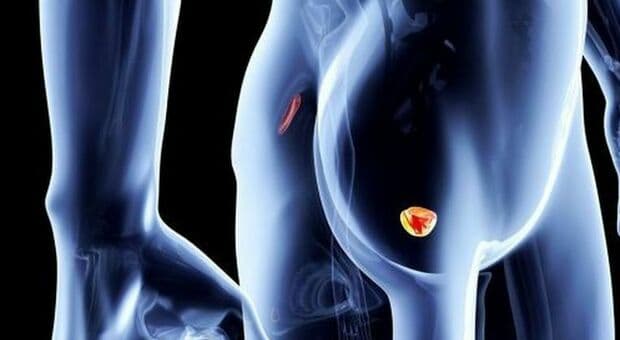  Tumore prostata, trattamento sperimentale uccide le cellule e riattiva l'immunità: il nuovo studio americano (e cosa potrebbe cambiare) 