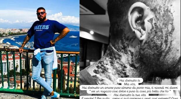  Valerio Gentile, morto l'uomo sfregiato con l'acido dalla ex. Sui social scriveva: «Hai distrutto la mia vita ma non riesco a odiarti» 