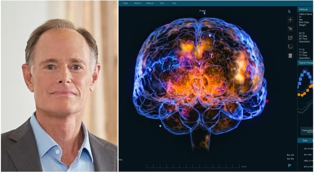  «Sono un esperto di Alzheimer, ecco le 6 cose che evito per ridurre il rischio di demenza» 