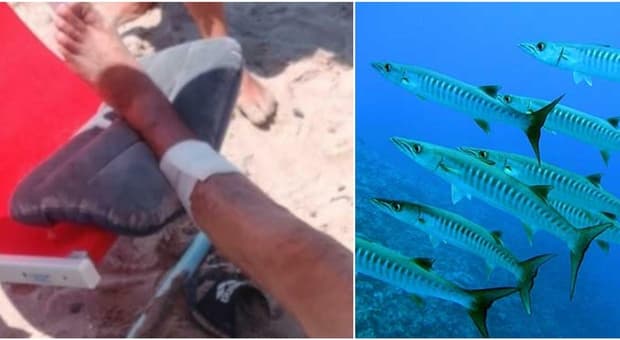  Turisti feriti dai pesci nel Cilento, ecco quali specie possono aver attaccato i bagnanti 