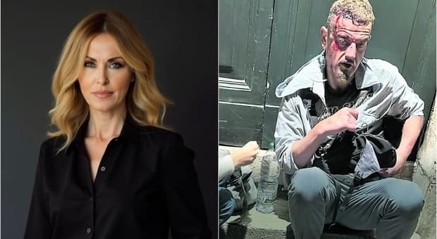  Roberta Bruzzone su Kaufmann: «Ha simulato: senza essersi curato la guarigione sarebbe un miracolo» 