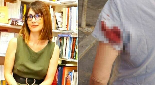  «Colpita da un proiettile vagante a Roma, in zona Prati. Attenzione c'è un uomo che spara con pistola ad aria compressa contro donne e turiste» 