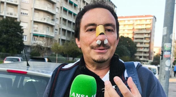  Torino, studente prende a pugni il prof e gli frattura il naso: Bruno Vadalà aggredito dopo l'interrogazione. «Violenza immotivata» 