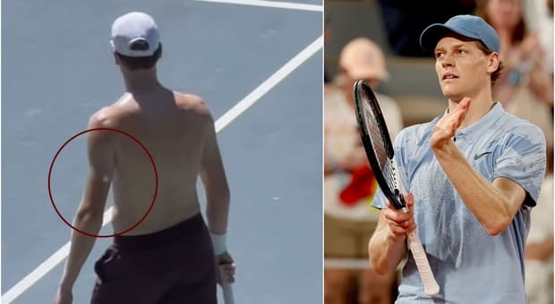  Sinner e lo strano cerotto sul braccio durante gli allenamenti a Montecarlo, cos'è e a cosa serve (e perché lo sta usando in ottica Wimbledon) 